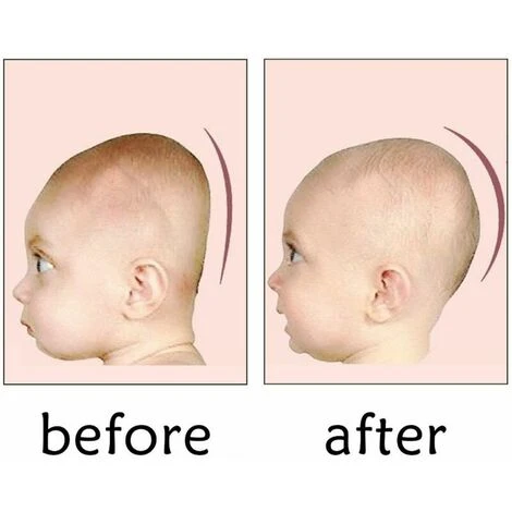 Cuscino Per Bebè Ortopedico Contro La Deformazione Testa Piatta Cuscino Per Bebè Morbido Regalo Rosa 5 Cuscino Per Bebè Ortopedico Contro La Deformazione Testa Piatta Cuscino Per Bebè Morbido Regalo Rosa - immagine 3